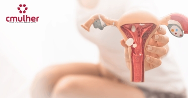 Endometriose: Causas e Sintomas