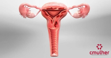 Adenomiose: Causas e Sintomas